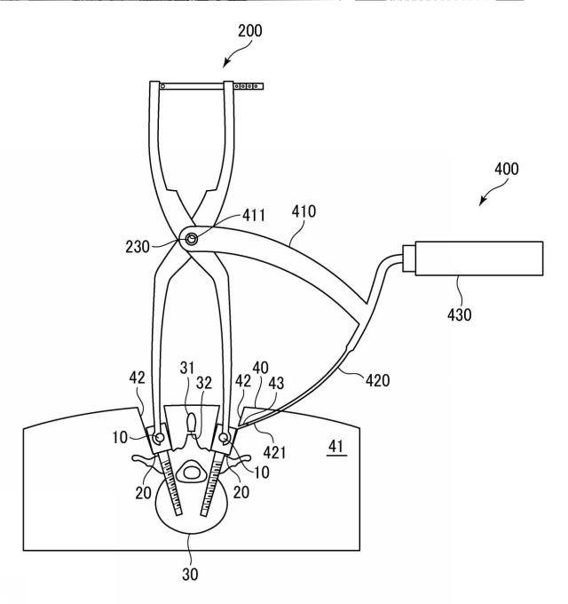 WO2017141459-トランスバース、および手術器具 図000016