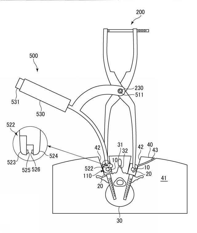 WO2017141459-トランスバース、および手術器具 図000017