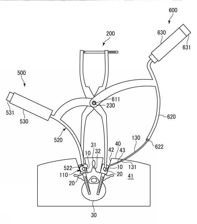 WO2017141459-トランスバース、および手術器具 図000018