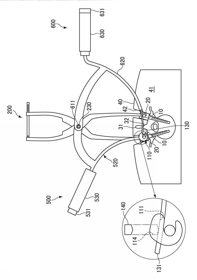 WO2017141459-トランスバース、および手術器具 図000019