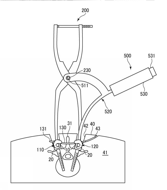 WO2017141459-トランスバース、および手術器具 図000020