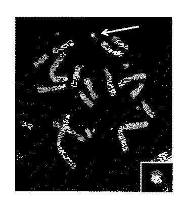 WO2018079857-ヒト抗体産生非ヒト動物及びそれを用いたヒト抗体作製法 図000021