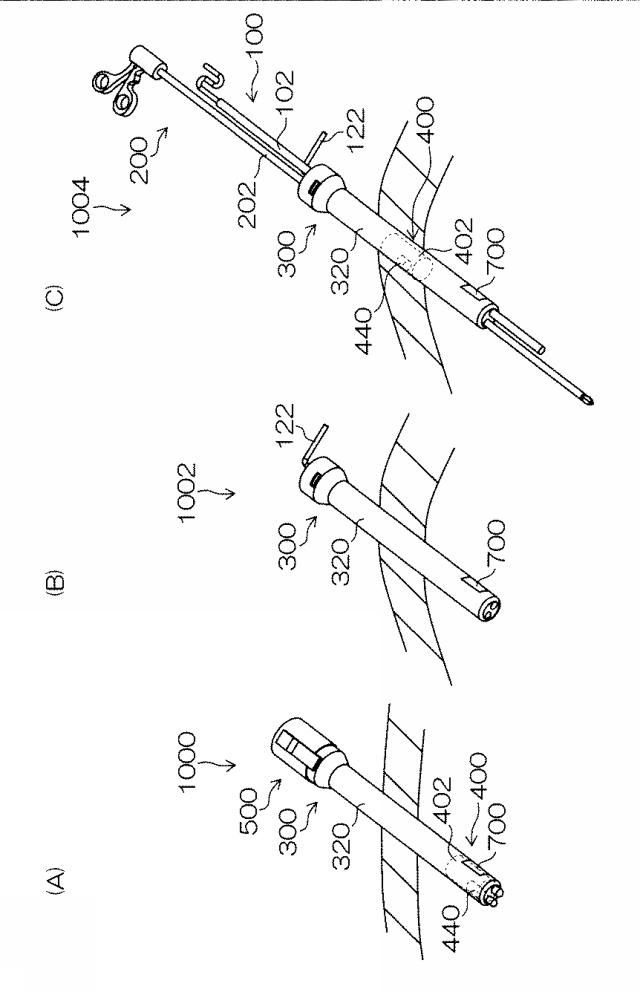 WO2015033909-内視鏡下外科手術装置及び外套管 図000029