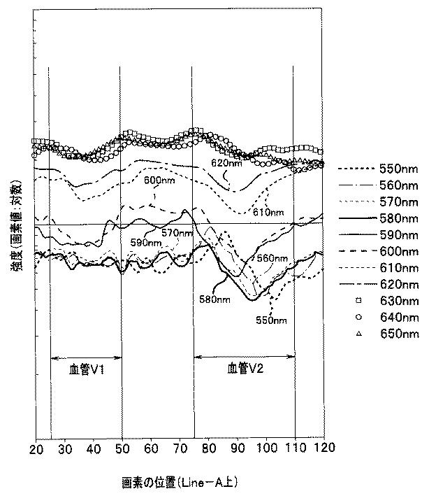 WO2013145410-内視鏡装置 図000030