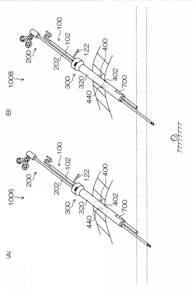 WO2015033909-内視鏡下外科手術装置及び外套管 図000030