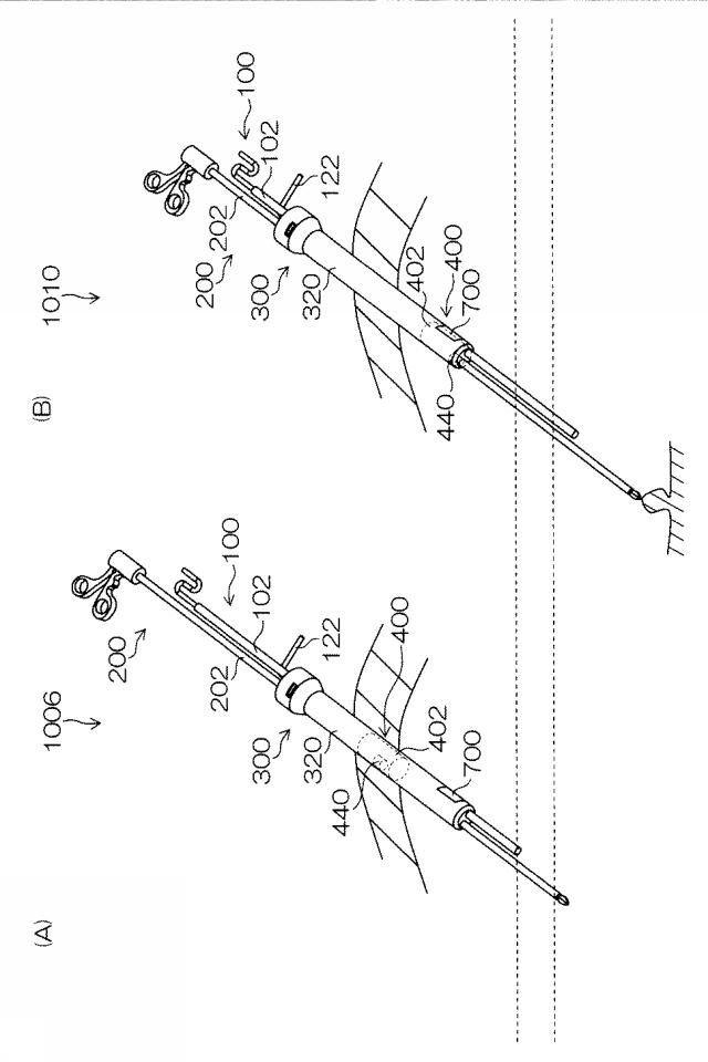 WO2015033909-内視鏡下外科手術装置及び外套管 図000031