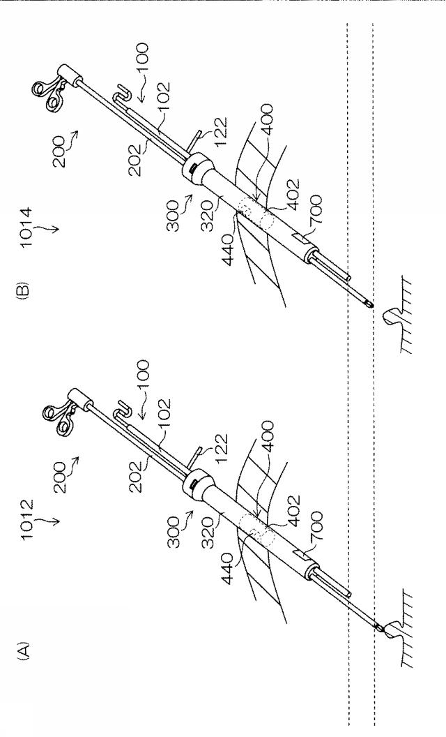 WO2015033909-内視鏡下外科手術装置及び外套管 図000032