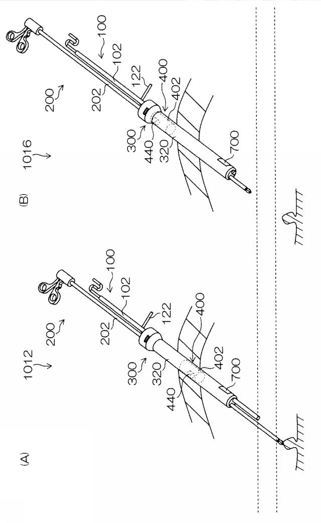 WO2015033909-内視鏡下外科手術装置及び外套管 図000033