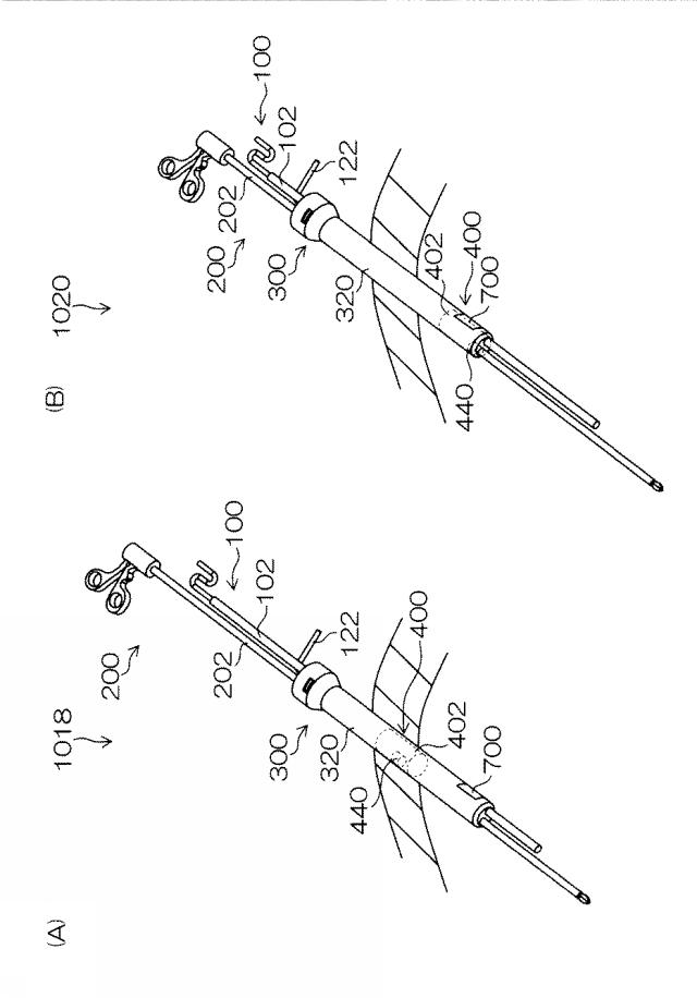 WO2015033909-内視鏡下外科手術装置及び外套管 図000034