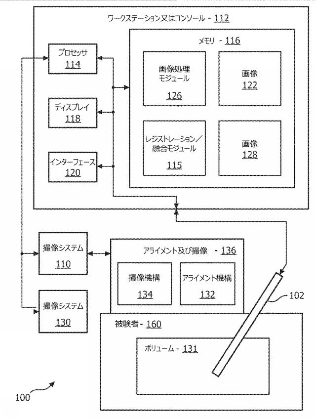 2017511728-同時Ｘ平面撮像を用いた画像レジストレーション及び誘導 図000003