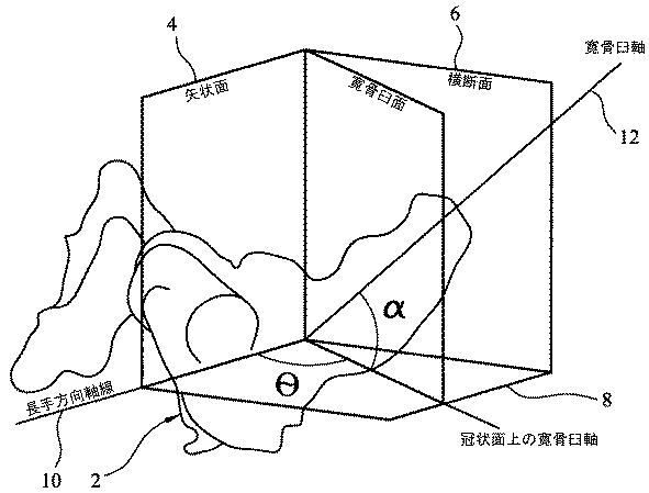 2019521806-股関節置換手術において使用される器具アセンブリ 図000003