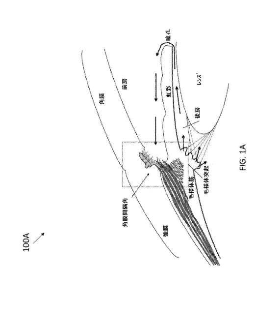 2020521612-低侵襲性緑内障外科手術デバイス、システム、および関連方法 図000003