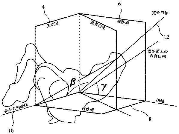 2019521806-股関節置換手術において使用される器具アセンブリ 図000004