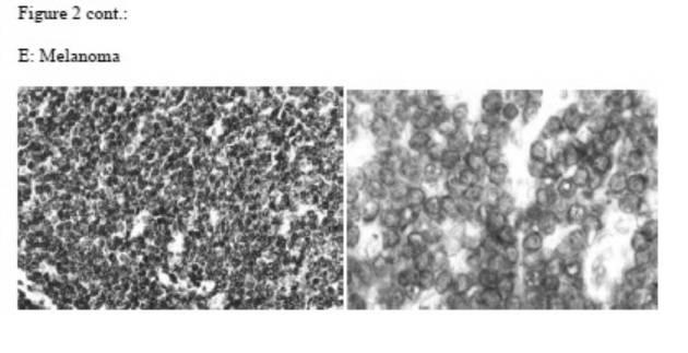 2019526813-ＴＩＲＣ７を基礎とする固形癌の診断及び治療 図000004