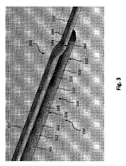 2017521177-複数の平坦部分を持つコアワイヤを有する血管内デバイス、システム及び方法 図000005