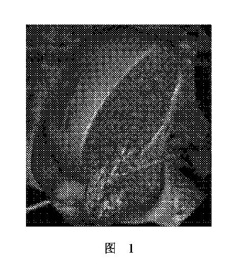 2020506452-ＨＭＤＳに基づく医学画像形成装置 図000005