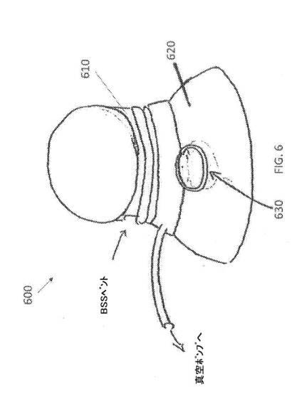 2020521612-低侵襲性緑内障外科手術デバイス、システム、および関連方法 図000009