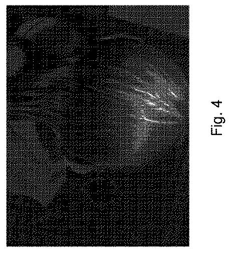 2021529154-損傷したケラチンの治療および／または予防のための方法 図000009