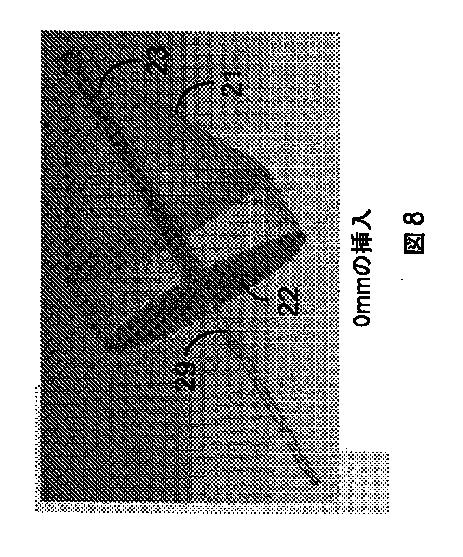 2017516536-光を伝達して反射させるためのカテーテル装置 図000010
