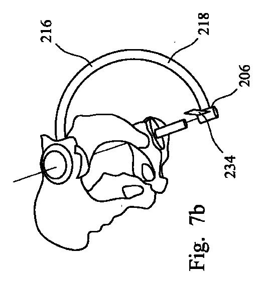 2019521806-股関節置換手術において使用される器具アセンブリ 図000010
