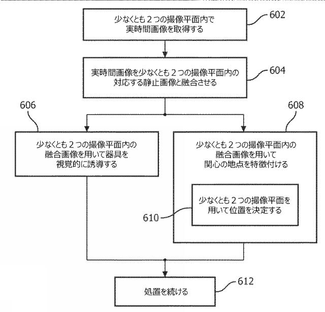 2017511728-同時Ｘ平面撮像を用いた画像レジストレーション及び誘導 図000011