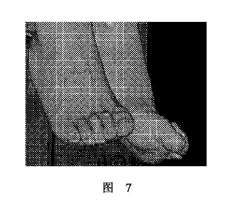 2020506452-ＨＭＤＳに基づく医学画像形成装置 図000011