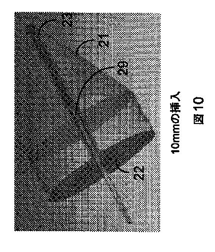 2017516536-光を伝達して反射させるためのカテーテル装置 図000012