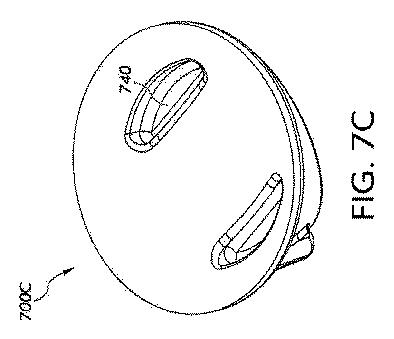 2020521612-低侵襲性緑内障外科手術デバイス、システム、および関連方法 図000012