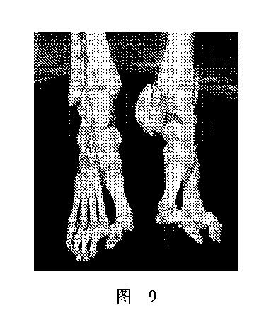 2020506452-ＨＭＤＳに基づく医学画像形成装置 図000013