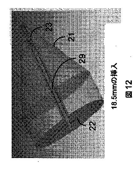 2017516536-光を伝達して反射させるためのカテーテル装置 図000014