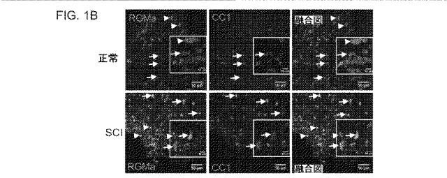 2019517480-脊髄損傷及び疼痛を処置するための抗ＲＧＭａ（Ｒｅｐｕｌｓｉｖｅ  Ｇｕｉｄａｎｃｅ  Ｍｏｌｅｃｕｌｅ  Ａ）アンタゴニスト抗体 図000014