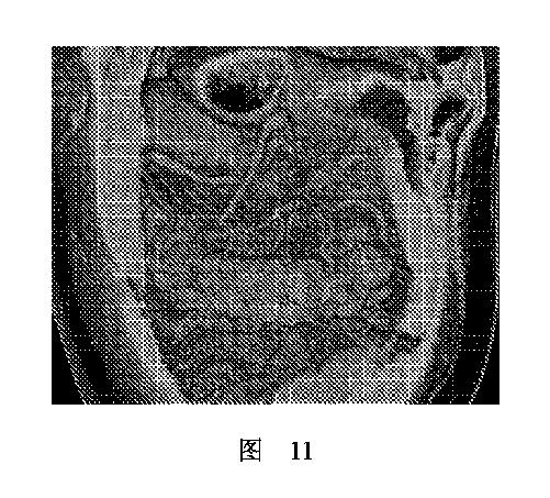 2020506452-ＨＭＤＳに基づく医学画像形成装置 図000015