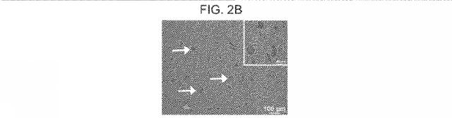 2019517480-脊髄損傷及び疼痛を処置するための抗ＲＧＭａ（Ｒｅｐｕｌｓｉｖｅ  Ｇｕｉｄａｎｃｅ  Ｍｏｌｅｃｕｌｅ  Ａ）アンタゴニスト抗体 図000017