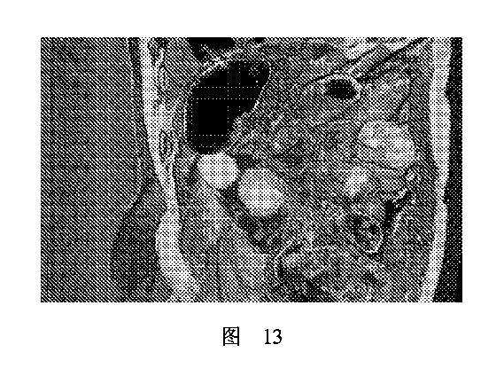 2020506452-ＨＭＤＳに基づく医学画像形成装置 図000017