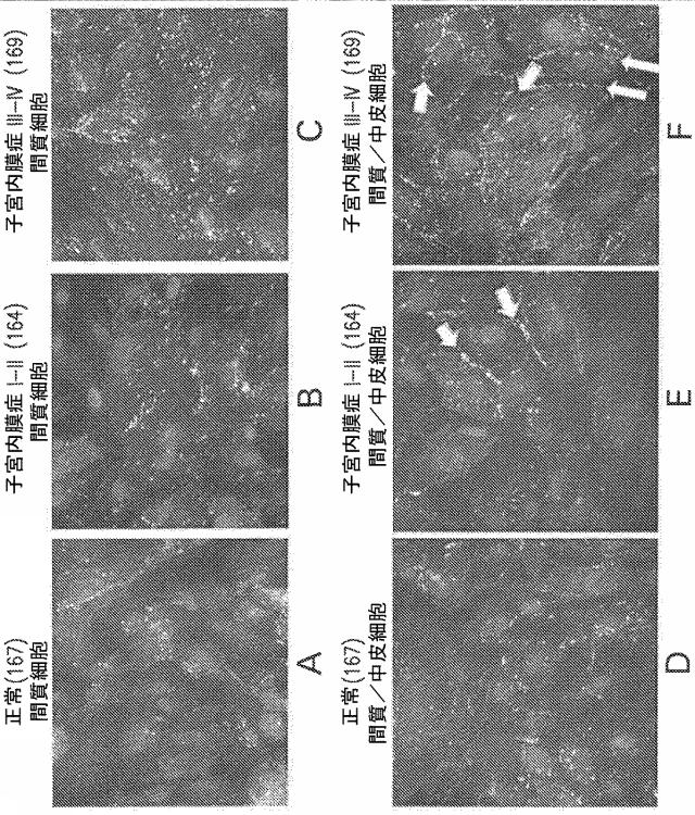 2021521803-子宮内膜症の治療のための組成物および方法 図000017