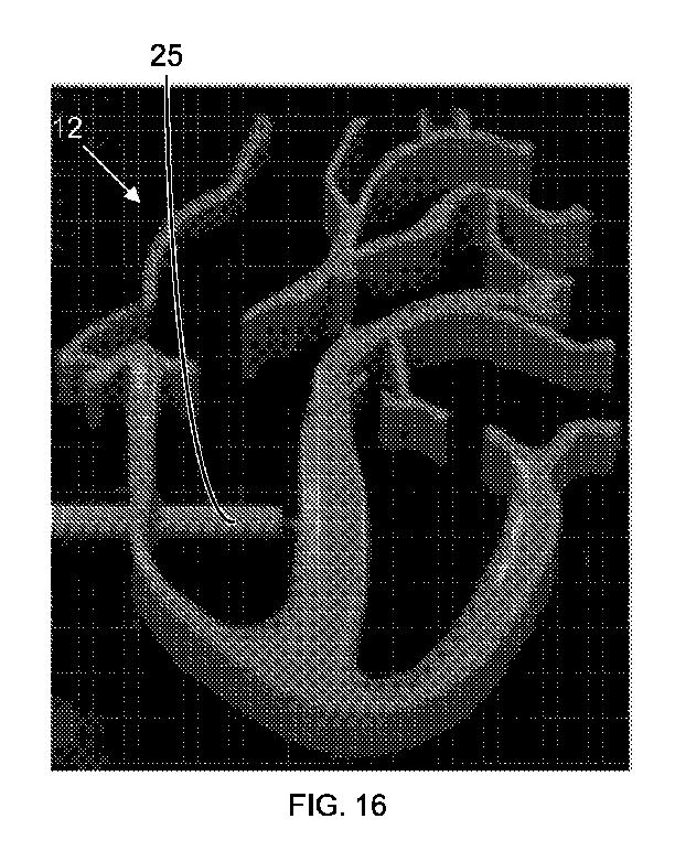 2017516536-光を伝達して反射させるためのカテーテル装置 図000018