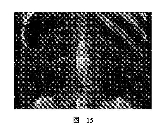 2020506452-ＨＭＤＳに基づく医学画像形成装置 図000019