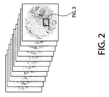 2021525361-空間マルチパラメータ細胞亜細胞画像データからの癌再発の予測 図000019