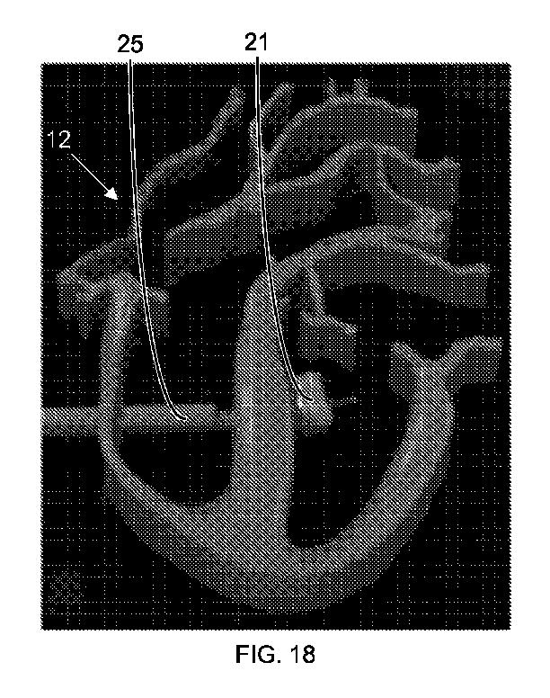 2017516536-光を伝達して反射させるためのカテーテル装置 図000020