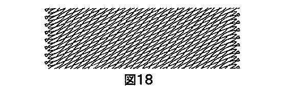 2018530386-植え込み可能弁及び方法 図000020