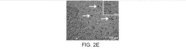 2019517480-脊髄損傷及び疼痛を処置するための抗ＲＧＭａ（Ｒｅｐｕｌｓｉｖｅ  Ｇｕｉｄａｎｃｅ  Ｍｏｌｅｃｕｌｅ  Ａ）アンタゴニスト抗体 図000020