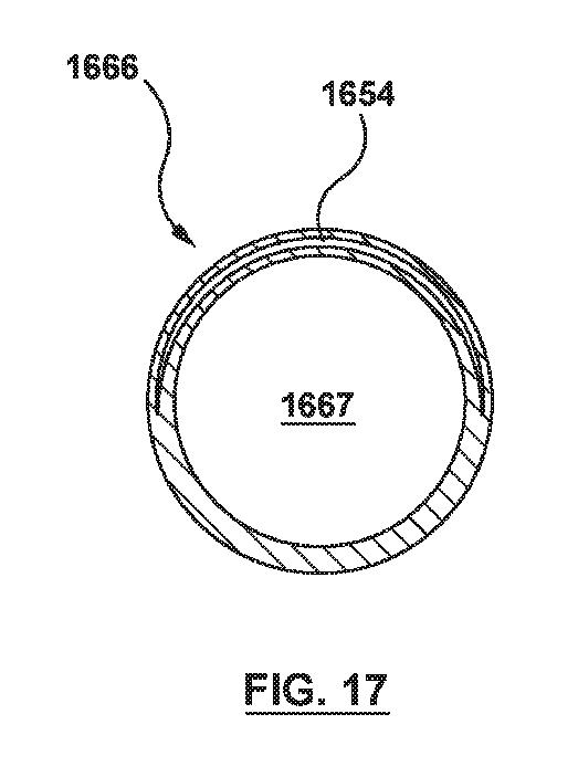 2020501633-原位置で腱索を管理するための一体型変位構成要素を有する弁送達システム、及びその使用方法 図000020