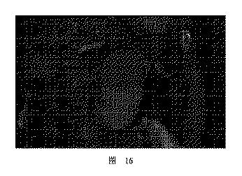 2020506452-ＨＭＤＳに基づく医学画像形成装置 図000020