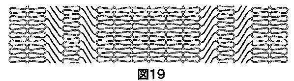 2018530386-植え込み可能弁及び方法 図000021