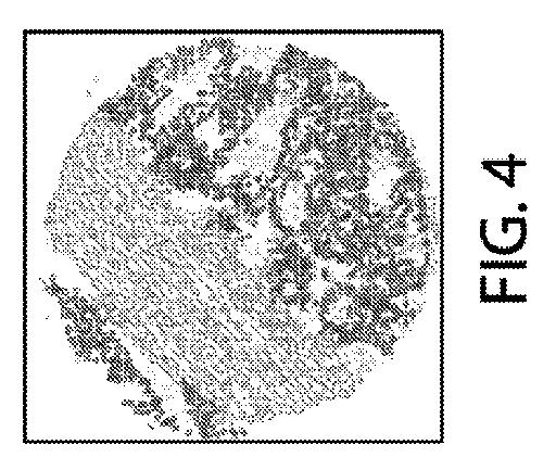 2021525361-空間マルチパラメータ細胞亜細胞画像データからの癌再発の予測 図000021