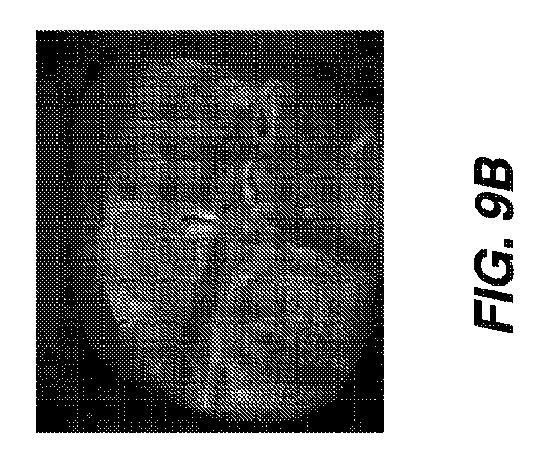 2019520897-拡張された被写界深度を有する口腔内イメージング装置 図000022