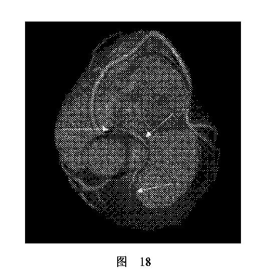 2020506452-ＨＭＤＳに基づく医学画像形成装置 図000022