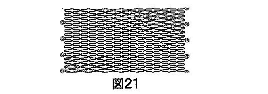 2018530386-植え込み可能弁及び方法 図000023