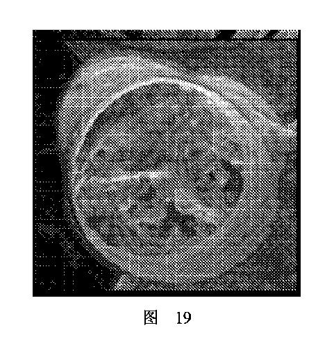 2020506452-ＨＭＤＳに基づく医学画像形成装置 図000023