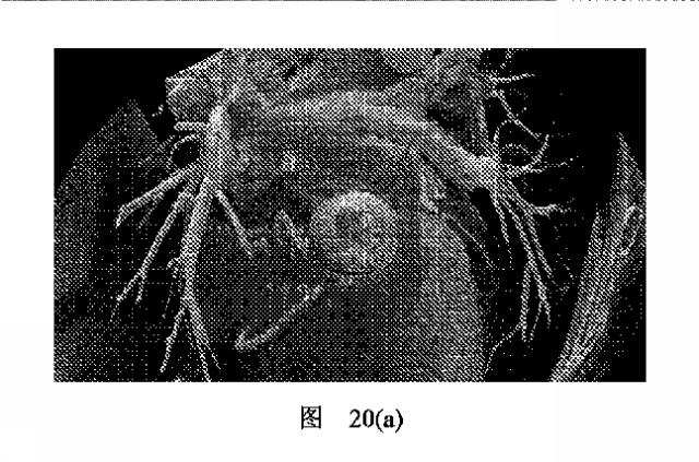 2020506452-ＨＭＤＳに基づく医学画像形成装置 図000024